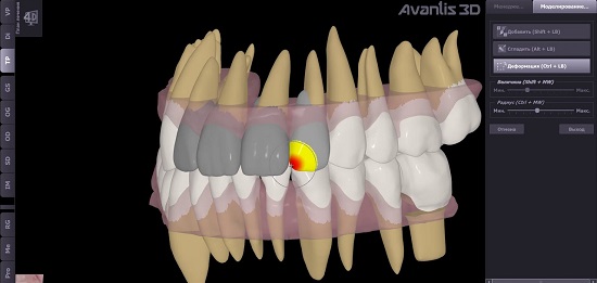 Технология 3D моделирования формы зубов