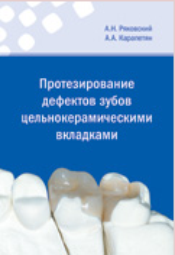 Протезирование дефектов зубов цельнокерамическими вкладками