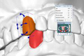 "OrthoCAD"