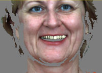 сканирование лица проектирование улыбки сканирование лица проектирование улыбки