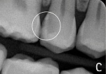 KaVo Diagnocam