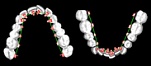 CAD/ CAM