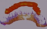 In Teeth